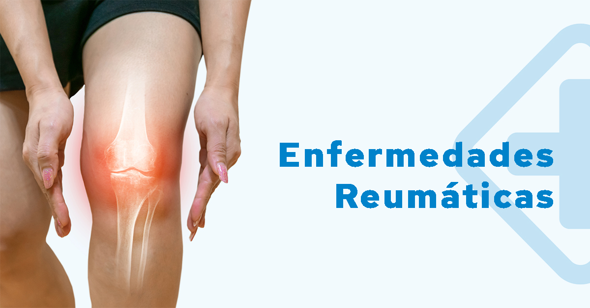 ¿Cómo prevenir enfermedades reumáticas?